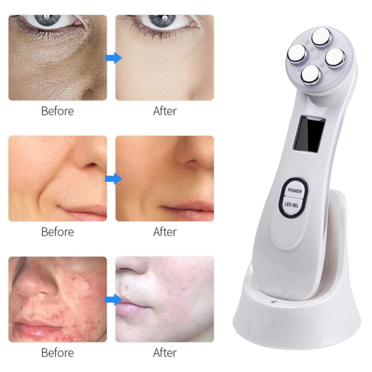 White radiofrequency skincare pen with LED display and control buttons on charging stand