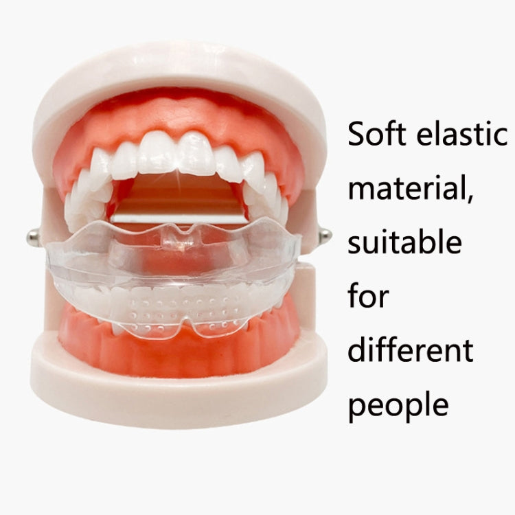 Transparent braces mouth guard fitted over a dental model with visible teeth