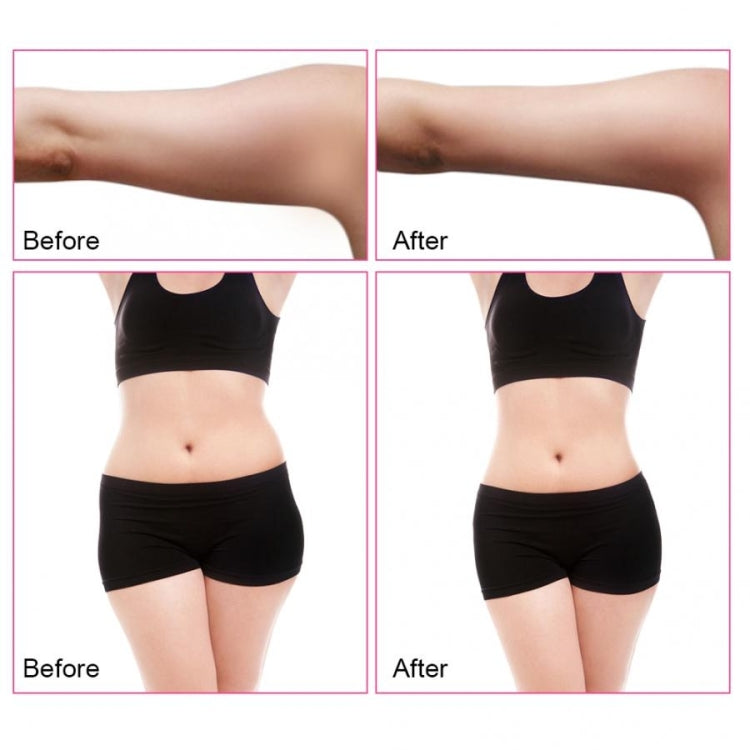 Before-and-after lower torso result showing slimmer waist area