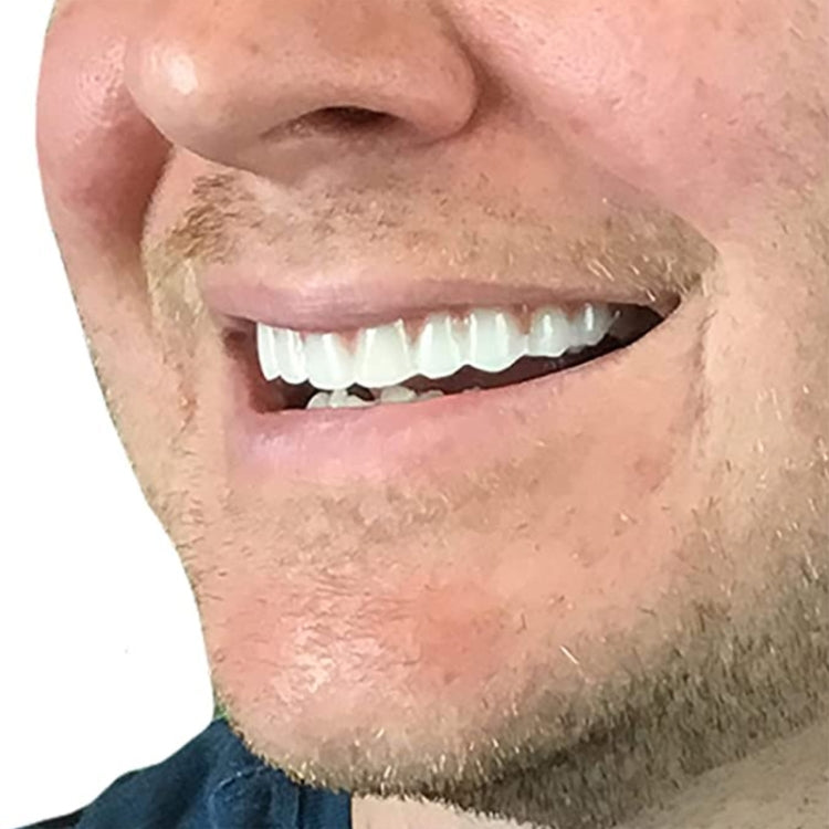Instant false teeth on lower face, bright white teeth covering the smile area