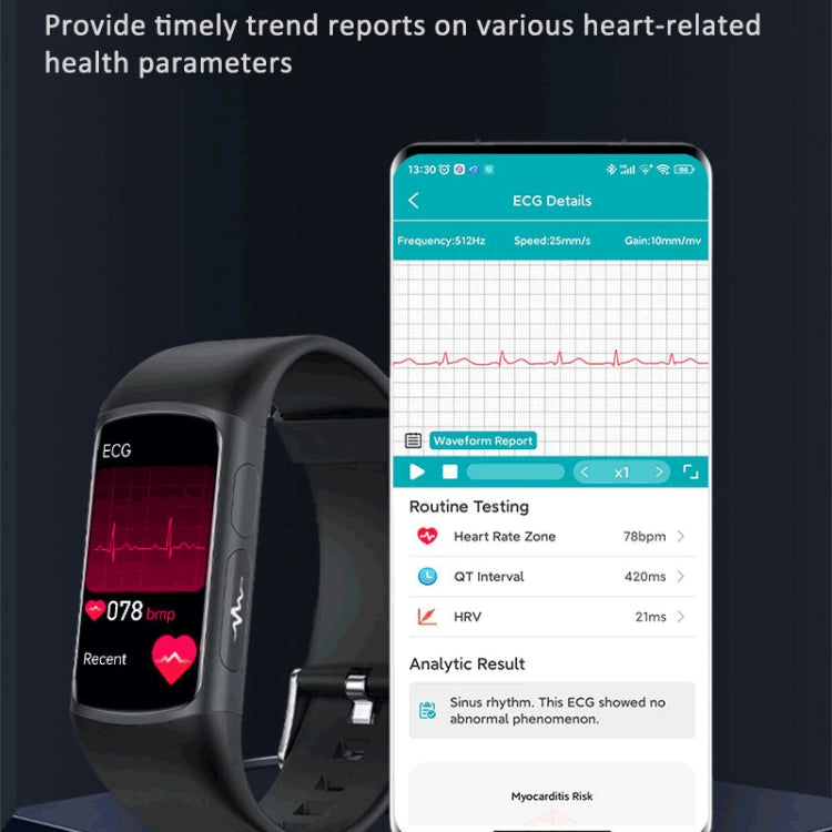 Black smartwatch bracelet with ECG-style screen on display