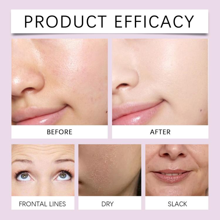 Facial wrinkle patches before-and-after results with smiling face panels