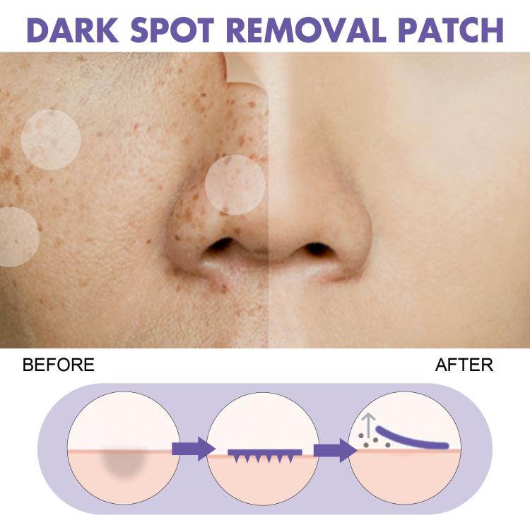 EELHOE Facial Blemish Moisturizing Acne Patches, Moisturizing Acne Patches