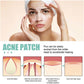 Breathable hydrocolloid acne patches on a woman’s forehead and cheeks with care diagram