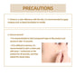 JAYSUING Waterproof Skin Scar Acne Mark Covering Patch, Acne Mark Covering Patch