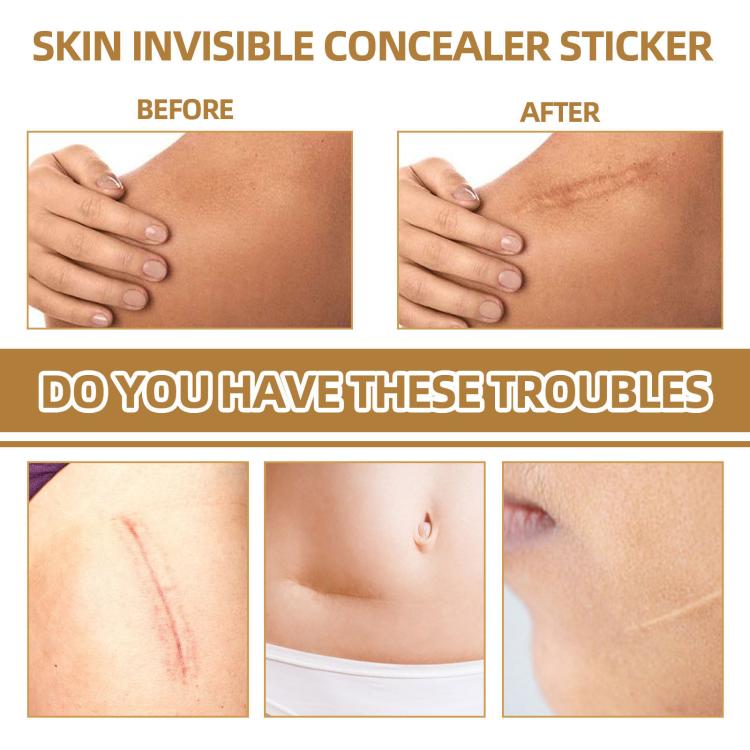 JAYSUING Waterproof Skin Scar Acne Mark Covering Patch, Acne Mark Covering Patch