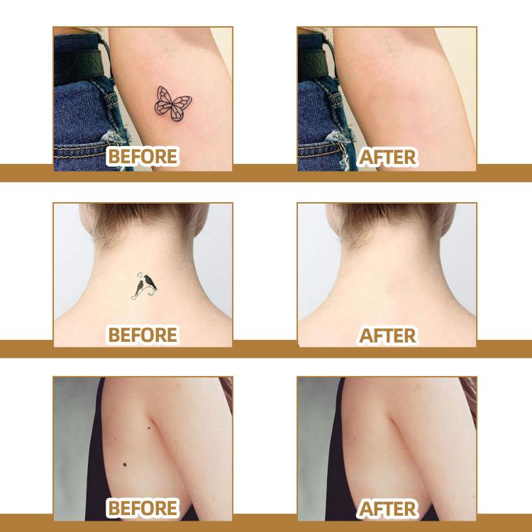 JAYSUING Waterproof Skin Scar Acne Mark Covering Patch, Acne Mark Covering Patch