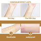 JAYSUING Waterproof Skin Scar Acne Mark Covering Patch, Acne Mark Covering Patch