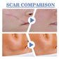 South Moon Thin Comfortable Silicone Care Pads, Silicone Care Pads