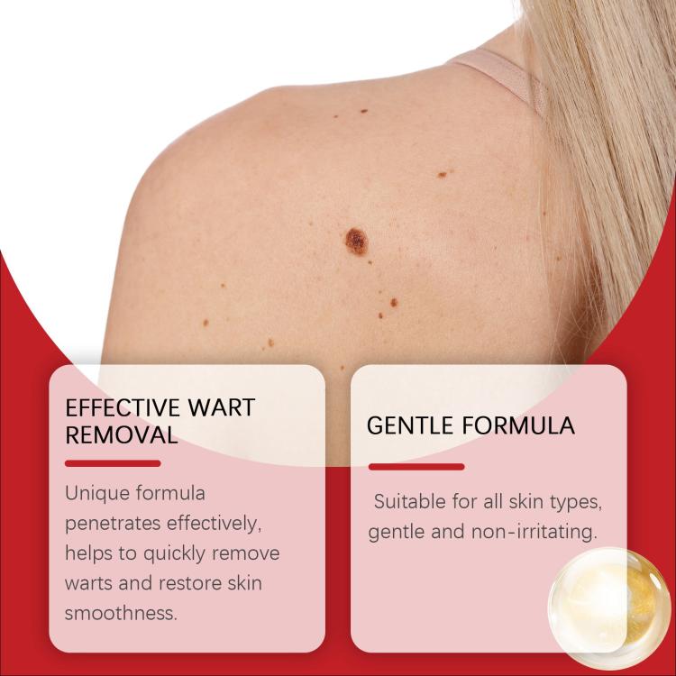 Skin tag patch concept with small blemishes on upper back and comfort callouts