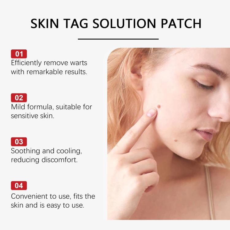 Skin tag solution patch benefits panel with 4 points and model showing small blemish