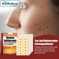 Hydrating care patches packaging with patches shown