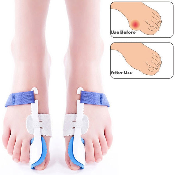 Night bunion splints with blue wrap straps and white toe supports on feet
