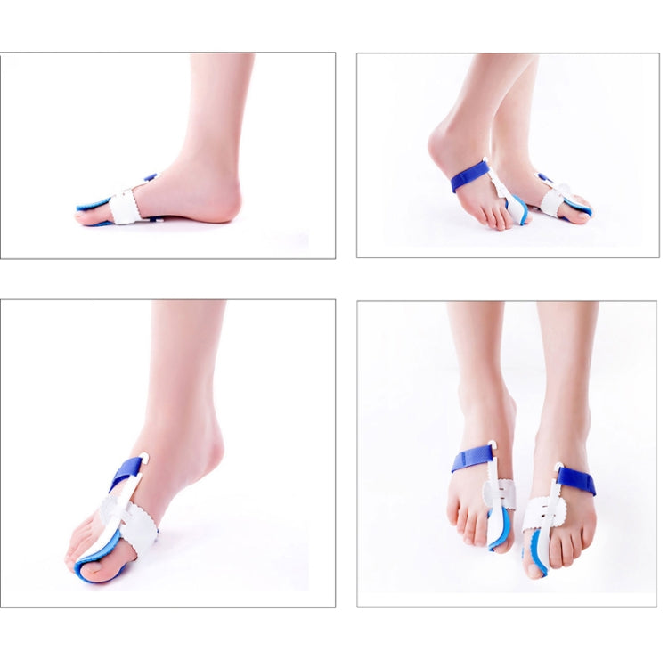 Night bunion splints shown on feet from multiple angles, blue straps