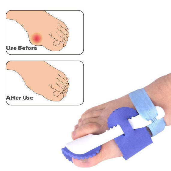 Blue night bunion splint straightener worn on toes with white cradle support