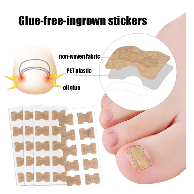 Glue-free ingrown nail sticker set, beige square patches on clear backing sheet
