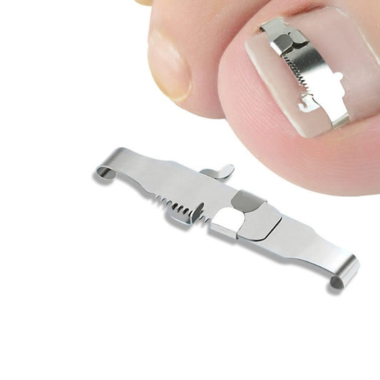 Orthopedic buckle toe nail corrector brace on toenail, close-up