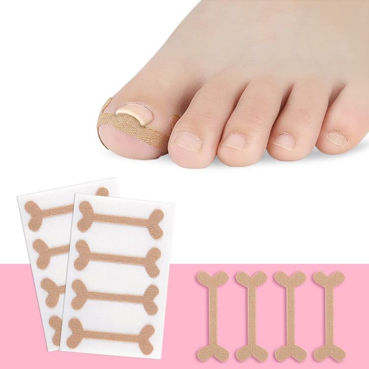 Toe nail correction tape on big toe, with beige fabric pads and backing cards