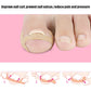 Big toe with beige nail groove correction tape applied near the nail edge