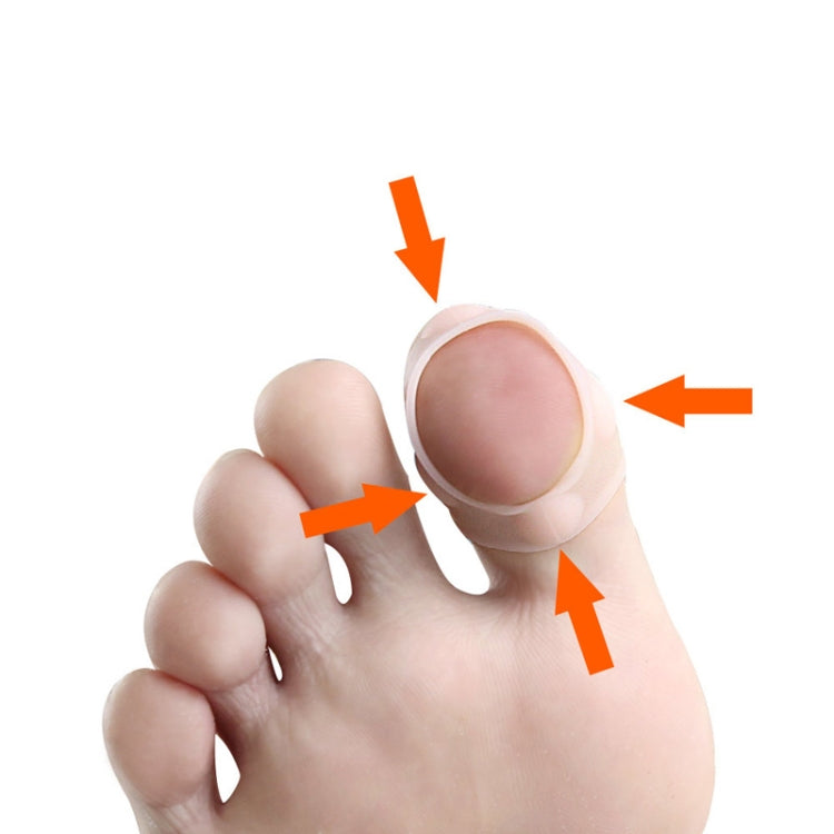 Light pink toe cap stretching over toenail, open top around the nail