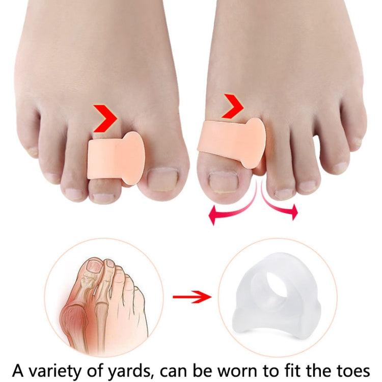 Peach toe separator on toes with arrows showing how it fits between toes.