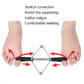 Toe corrector brace with black strap and silver spring; red arrows show toe alignment