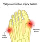 Foot bunion and valgus correction diagram highlighting structural areas