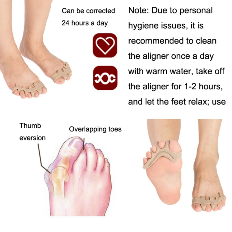 Silicone toe splitter corrector, molded to fit and separate toes