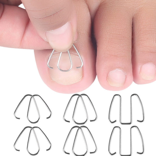 Toe nail orthotic wire hooks and hand placement on toenail