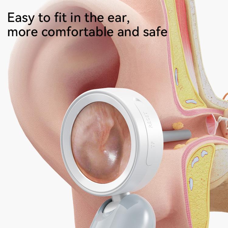 Ear Camera Wit IPS Display 1080P Camera Ear Check Portable Inspector, Q10