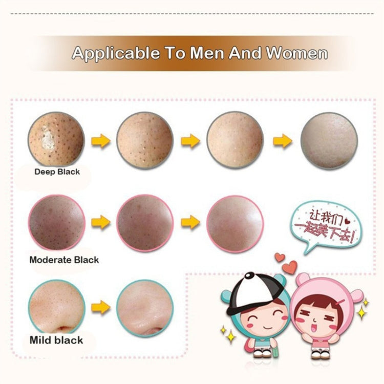 Blackhead removal chart showing before-and-after skin spots across three black levels